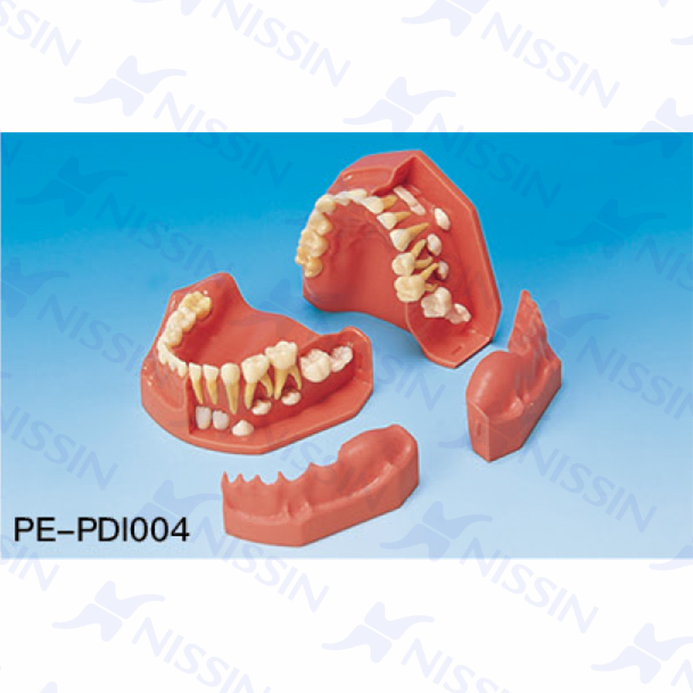 牙列發(fā)育模型(6/3歲)