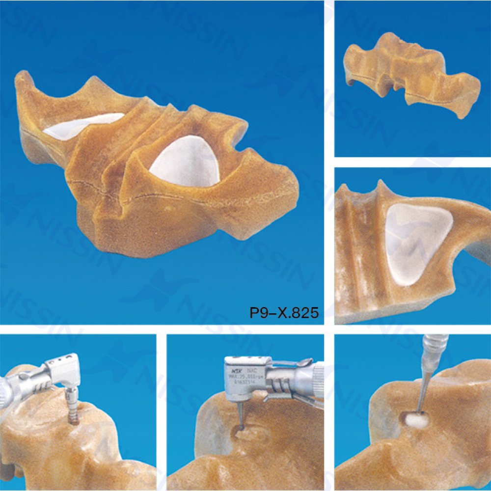 上頜竇底提升實習(xí)用模型