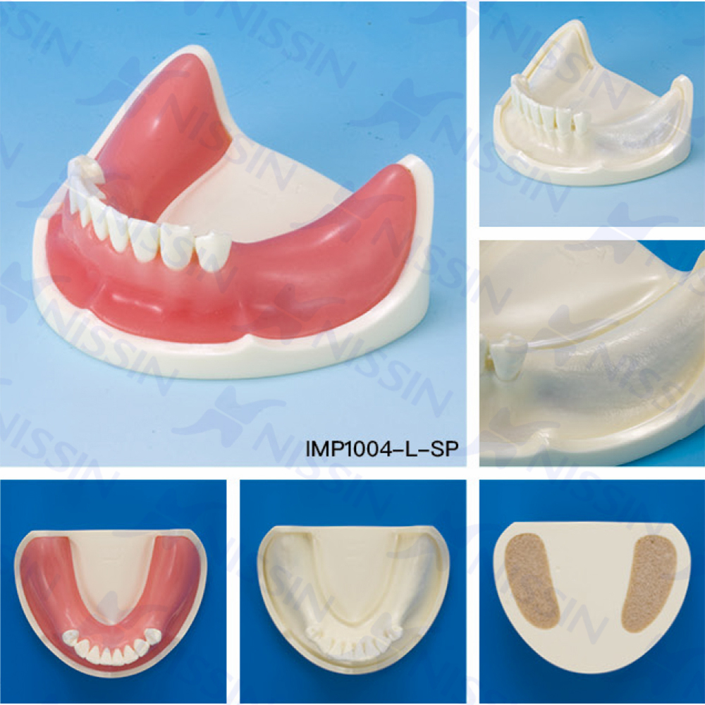 種植實習(xí)用牙頜模型